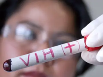 Muestra de VIH en un laboratorio Muestra de VIH en un laboratorio