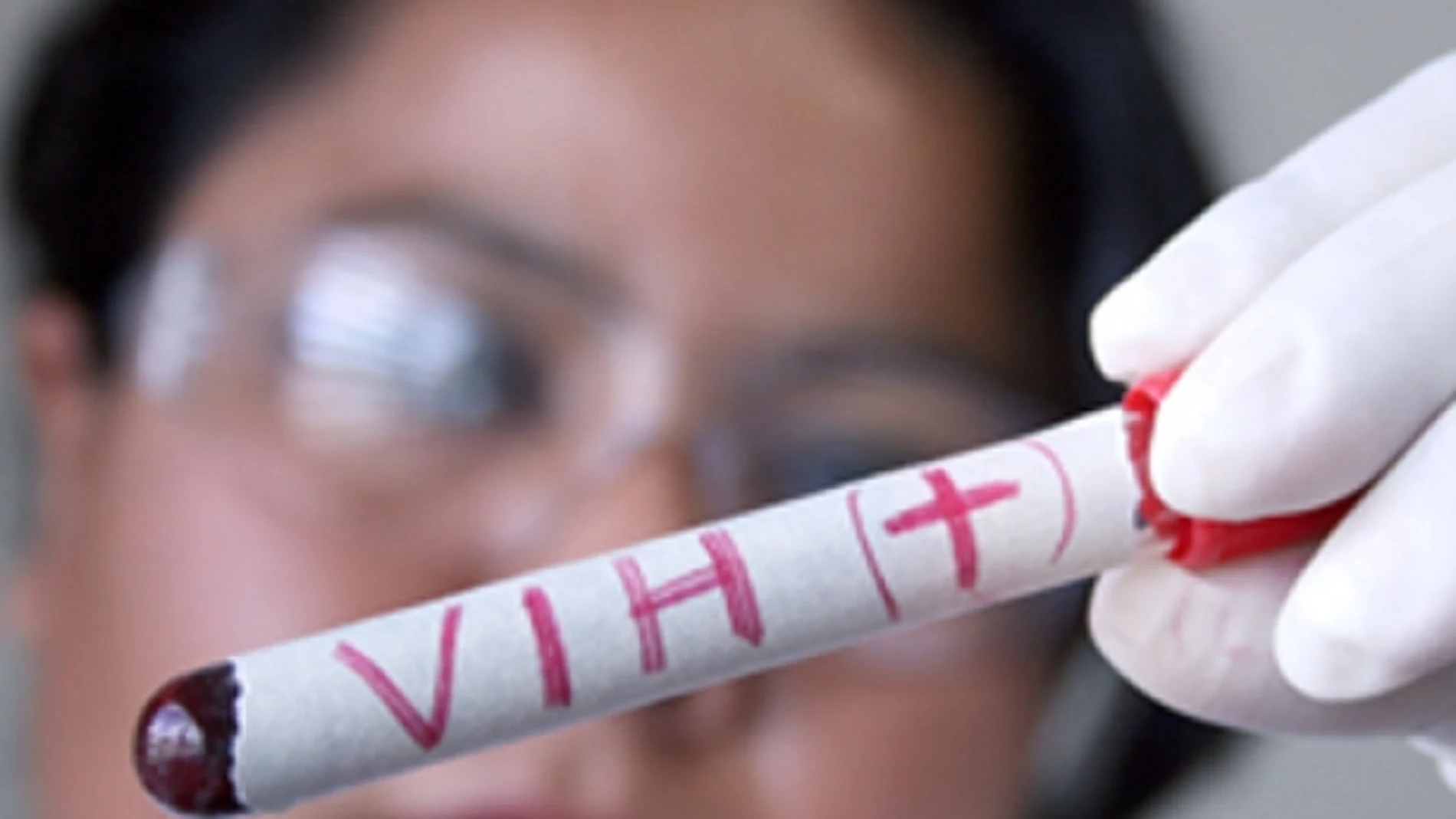 Muestra de VIH en un laboratorio Muestra de VIH en un laboratorio