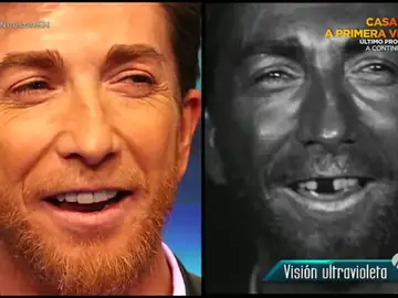 Los efectos del Sol en nuestra piel Los efectos del Sol en nuestra piel