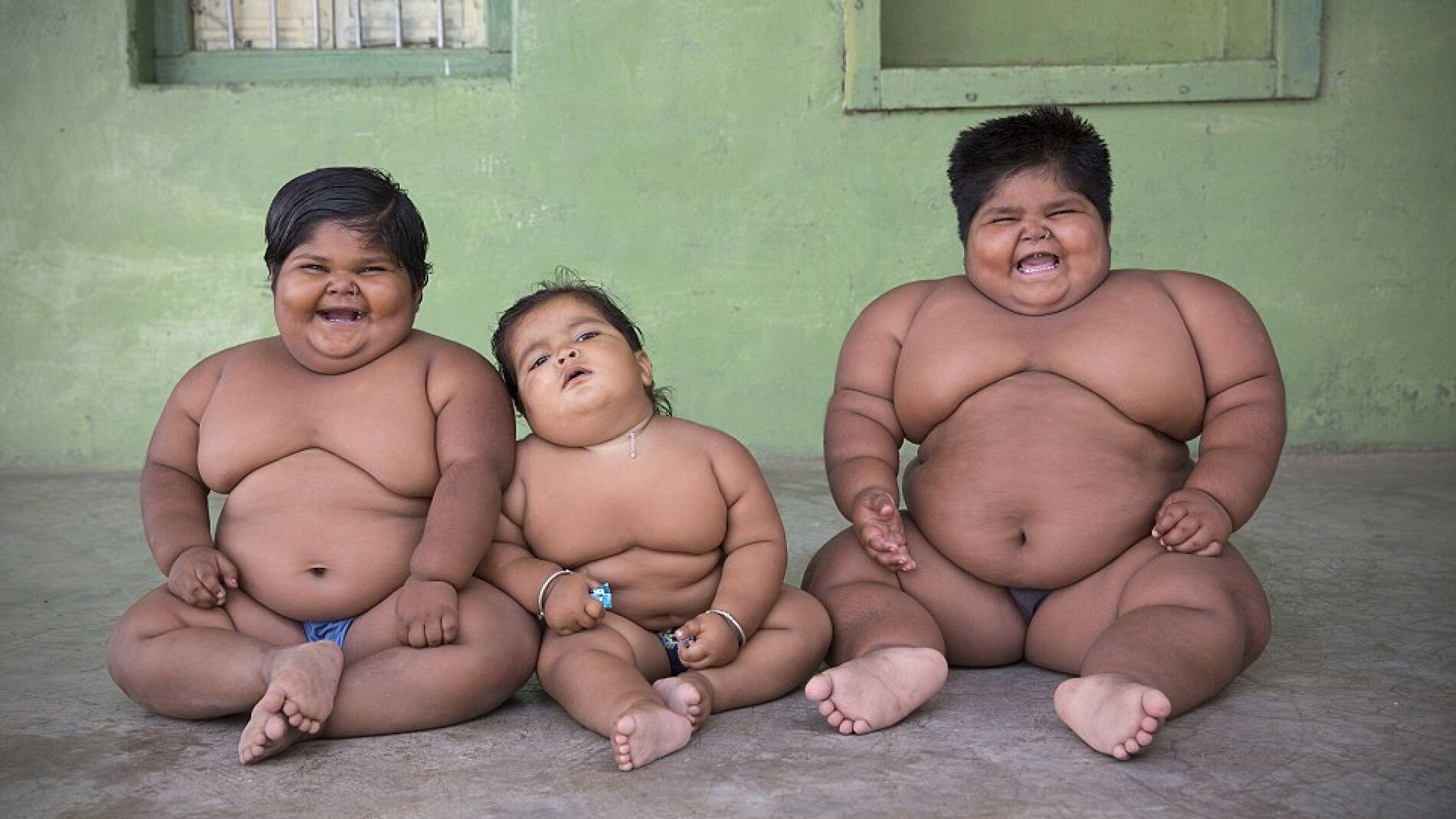 Los tres ni&ntilde;os indios con obesidad m&oacute;rbida