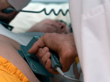 Avance de Vis a vis Avance de Vis a vis