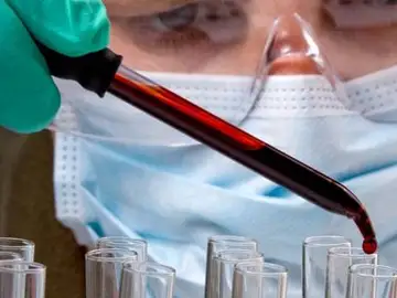 Una gota de sangre para descubrir los virus que han infectado a una persona Una gota de sangre para descubrir los virus que han infectado a una persona