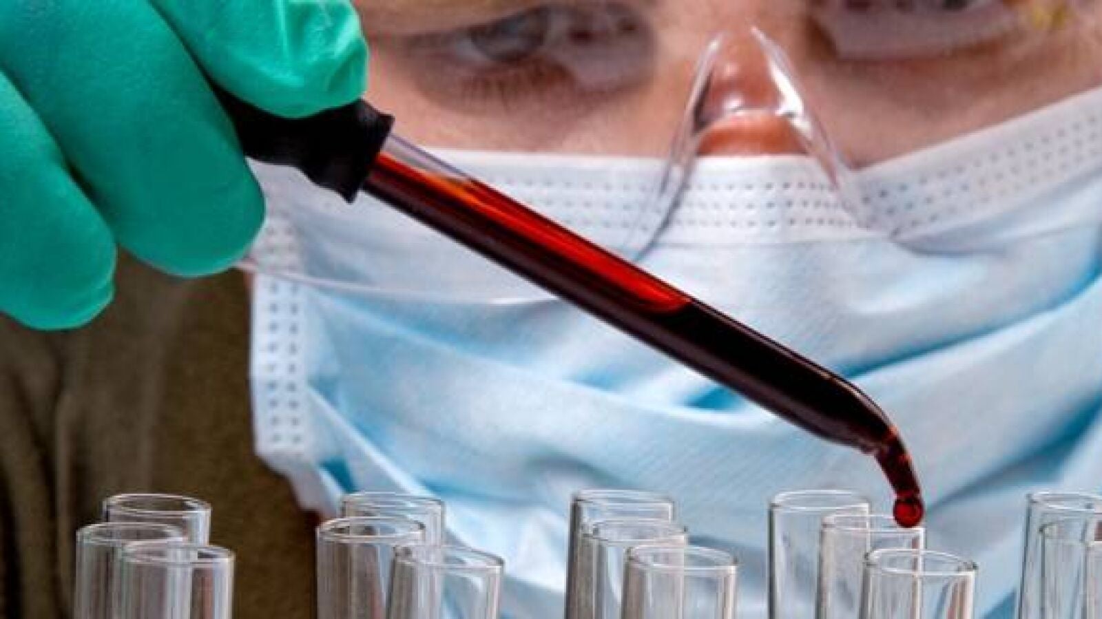 Desarrollan una técnica para detectar el cáncer con una sola gota de sangre