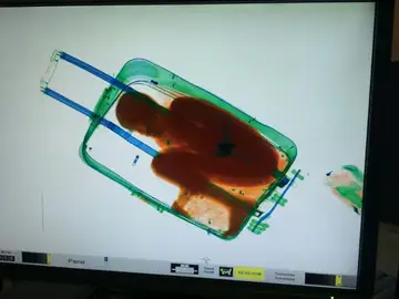Niño en maleta Niño en maleta