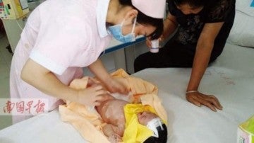 El bebé siendo examinado tras 8 días enterrado.