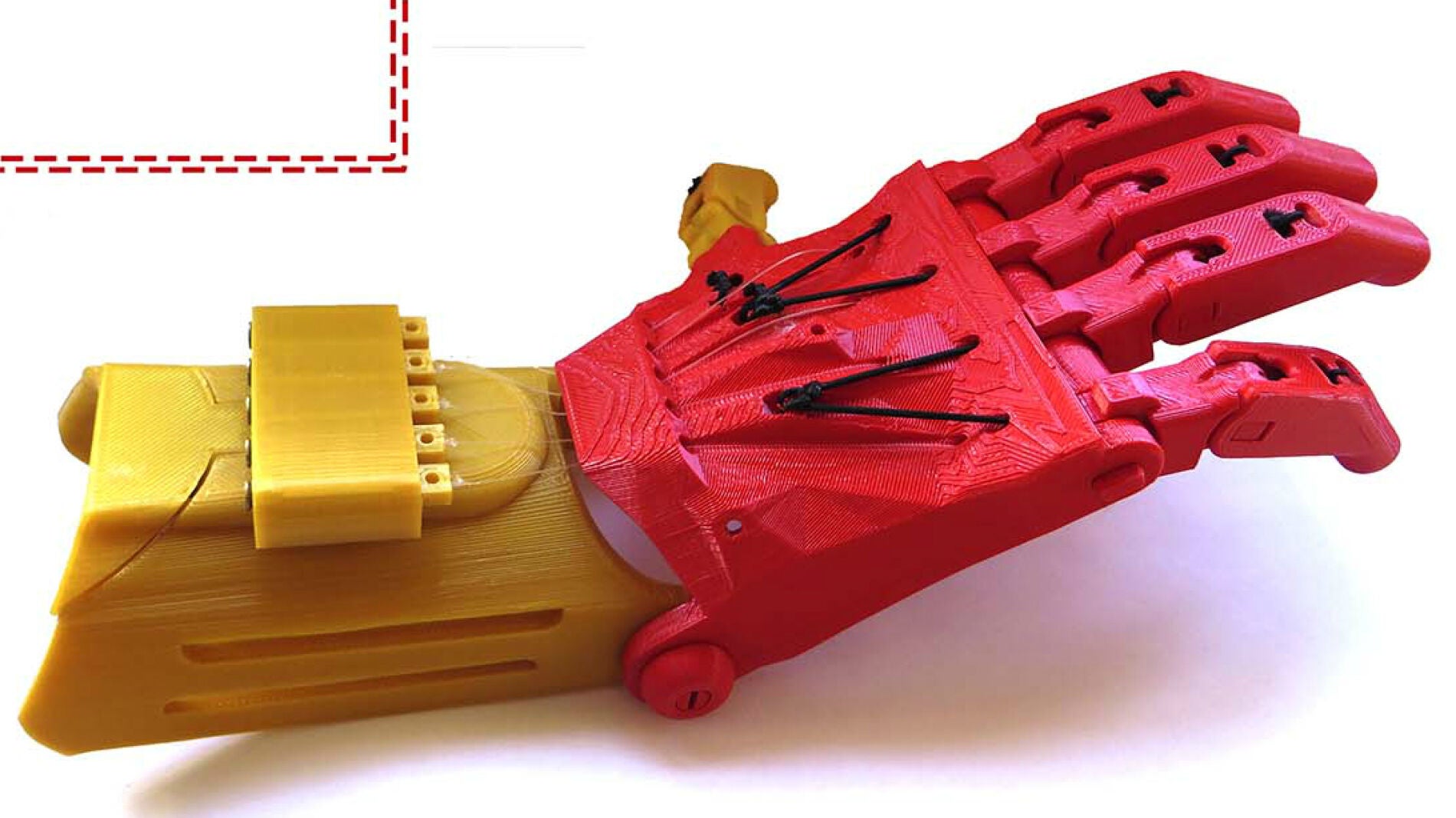 Pr&oacute;tesis de la mano