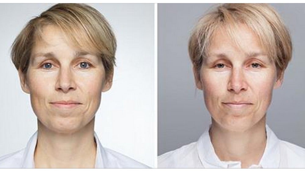 Así cambia el rostro al dormir menos de ocho horas