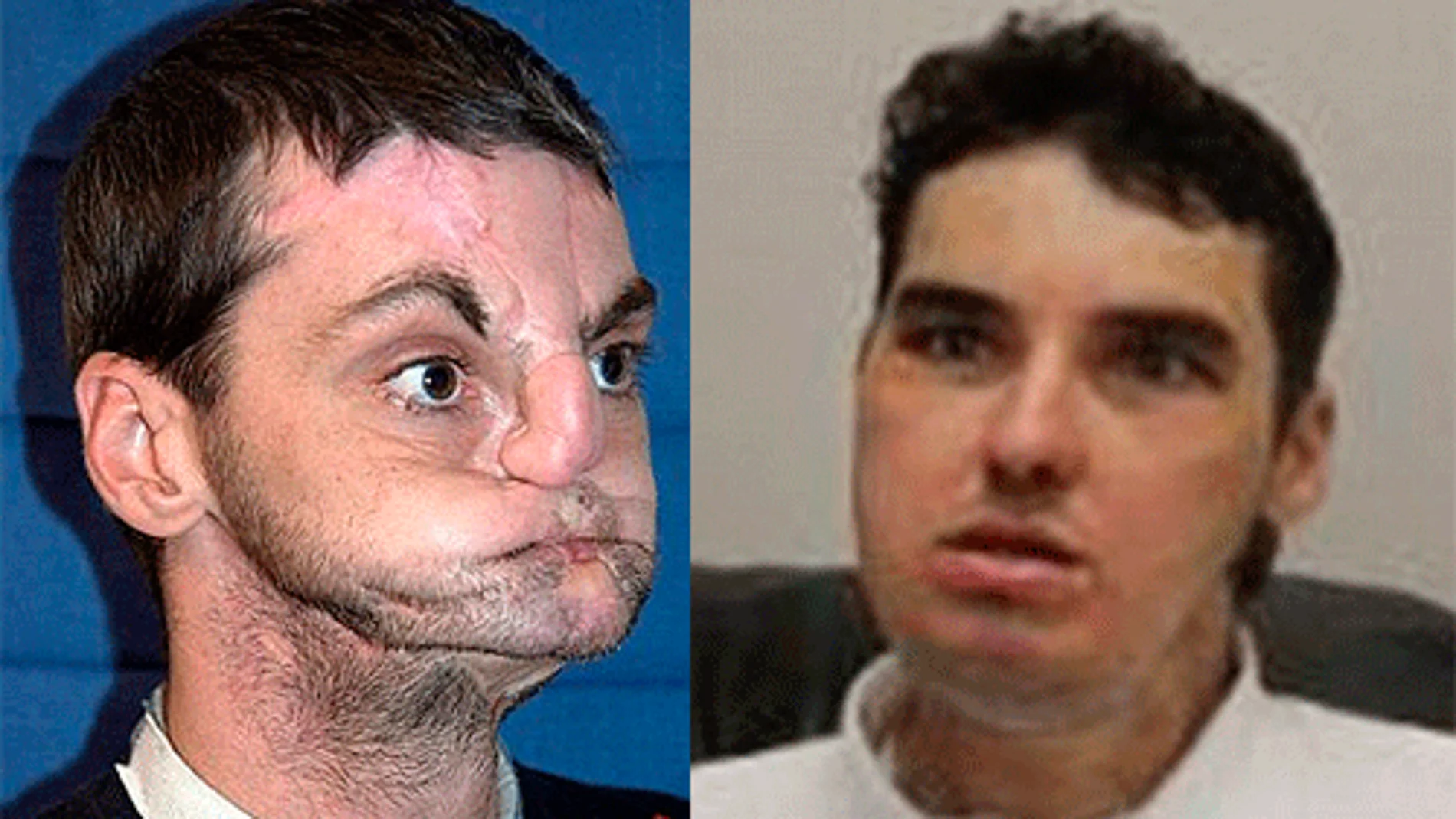 El antes y después de Richard Norris El antes y después de Richard Norris