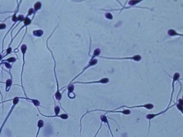 Espermatozoides en el microscopio.