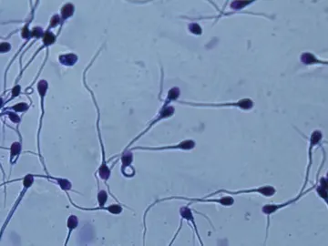 Espermatozoides en el microscopio. Espermatozoides en el microscopio.
