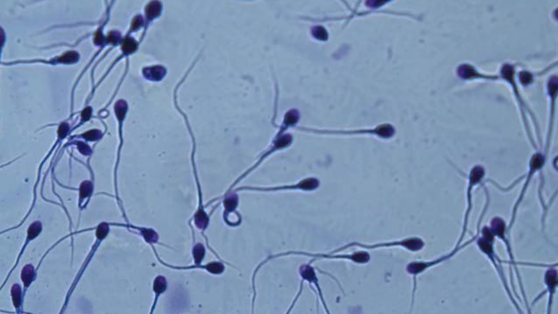 Espermatozoides en el microscopio. Espermatozoides en el microscopio.