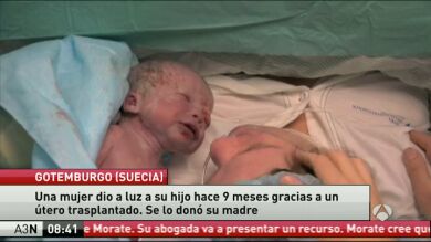 Una mujer da a luz a su hijo gracias a un útero trasplantado