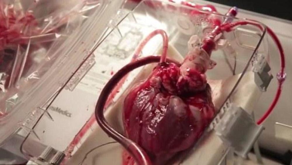 Un corazón late en una máquina que permite su funcionamiento fuera del cuerpo humano.