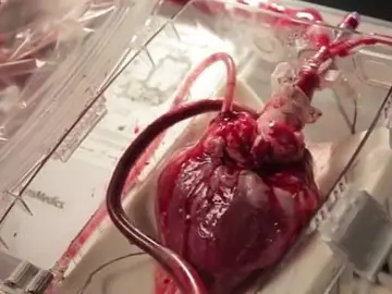 Un corazón late en una máquina que permite su funcionamiento fuera del cuerpo humano. Un corazón late en una máquina que permite su funcionamiento fuera del cuerpo humano.