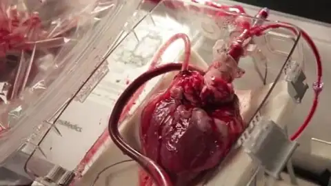 Un corazón late en una máquina que permite su funcionamiento fuera del cuerpo humano. Un corazón late en una máquina que permite su funcionamiento fuera del cuerpo humano.