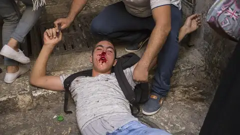 Decenas de palestinos han resultado heridos en los disturbios Decenas de palestinos han resultado heridos en los disturbios