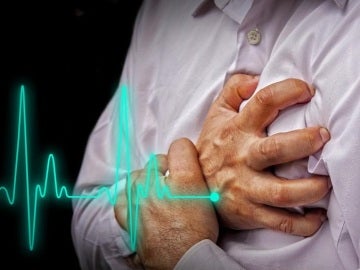 Infarto de miocardio