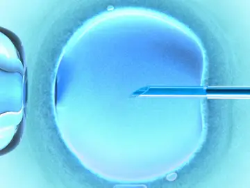 Imagen de un proceso de inseminación Imagen de un proceso de inseminación