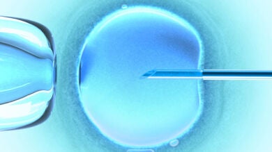 Un hospital holandés investiga un posible error en una inseminación a 26 mujeres
