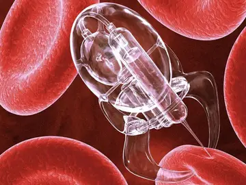 Nanorobots Nanorobots
