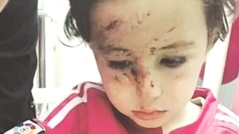 Haidar, huerfano tras un atentado en Beirut