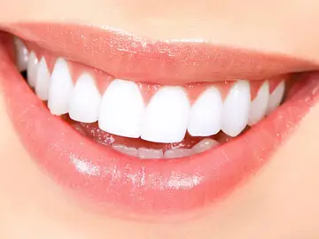Imagen de la sonrisa de una mujer Imagen de la sonrisa de una mujer