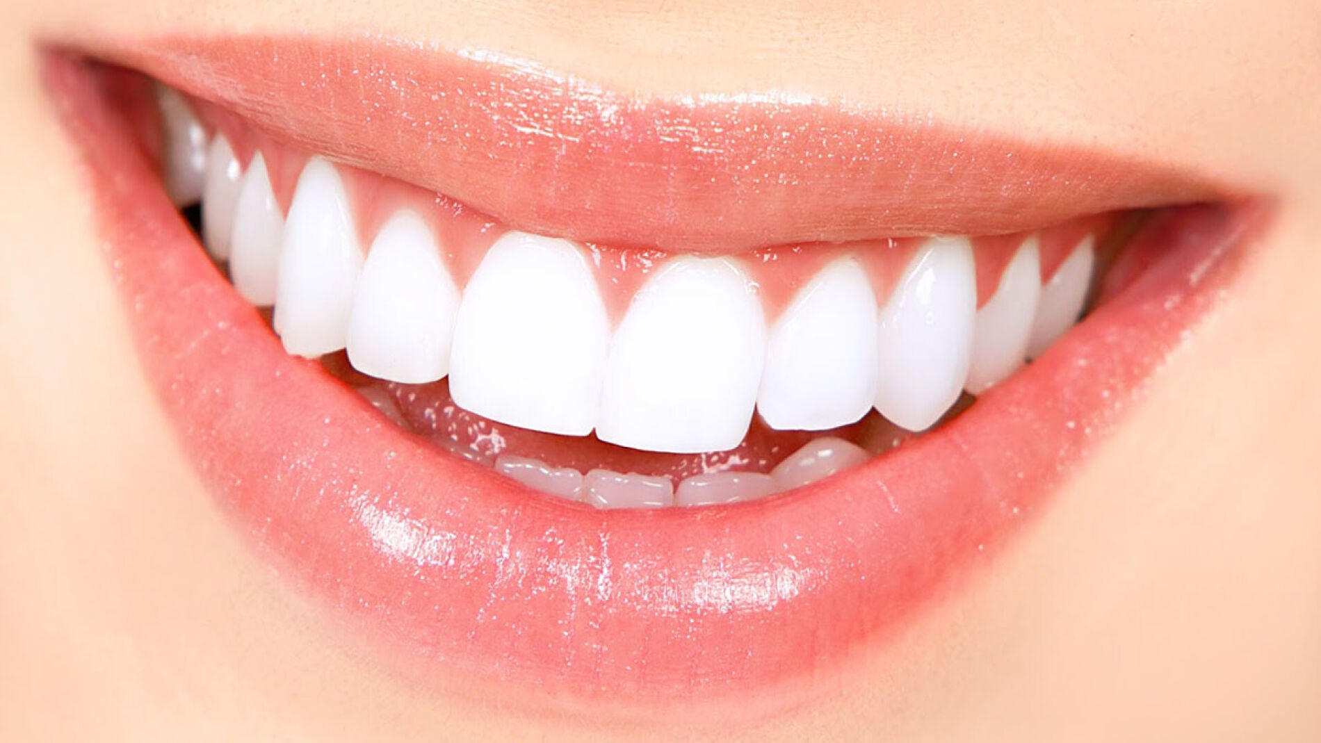 Imagen de la sonrisa de una mujer