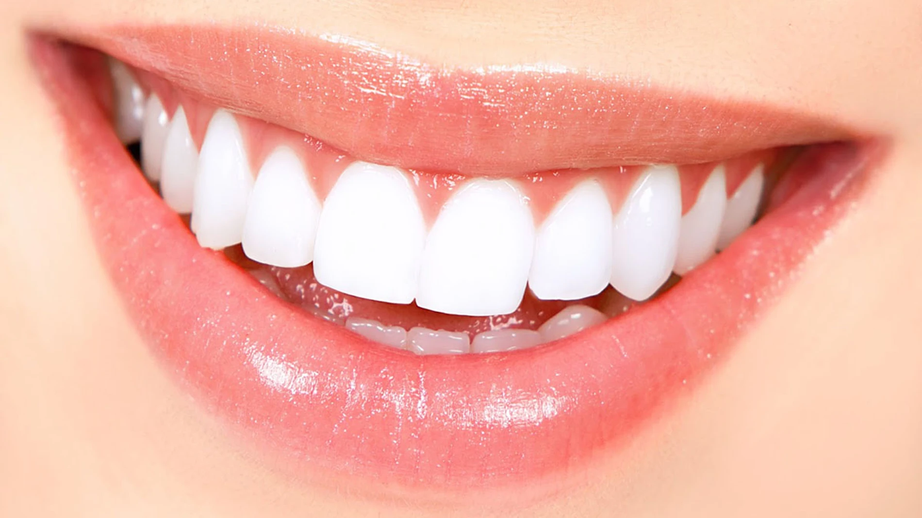 Imagen de la sonrisa de una mujer Imagen de la sonrisa de una mujer