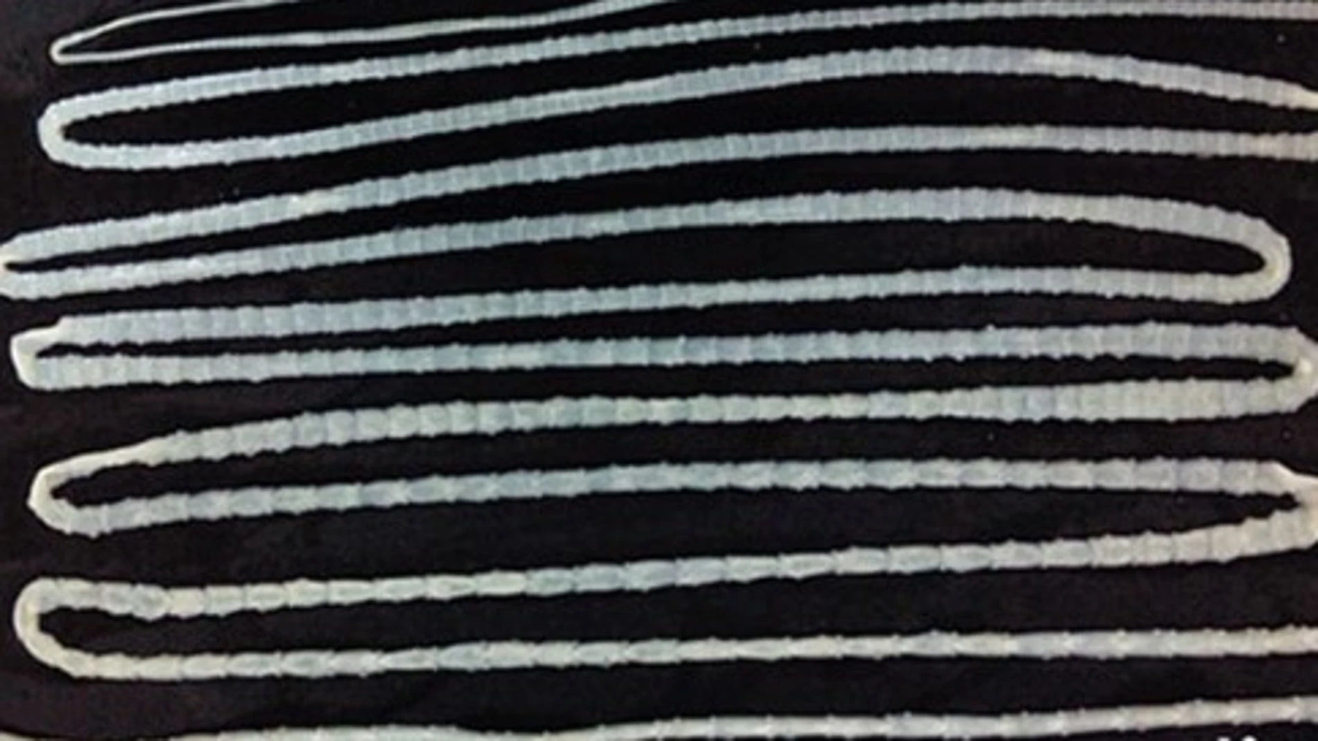 Vista del parásito de la 'Taenia Saginata' Vista del parásito de la 'Taenia Saginata'