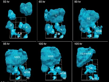 Evolución de un tumor Evolución de un tumor