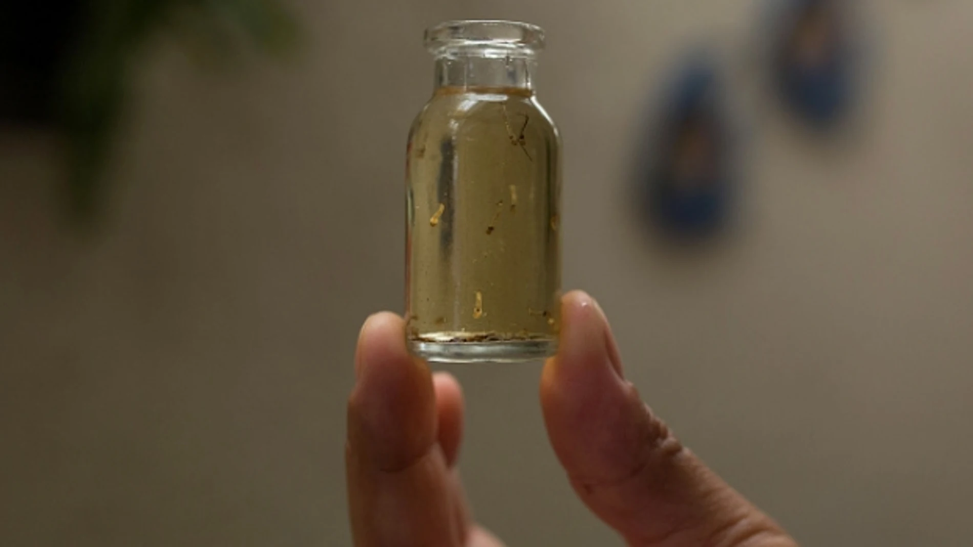 Analizan el virus zika Analizan el virus zika