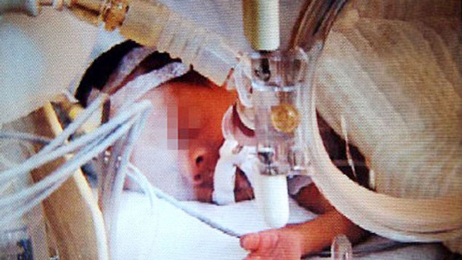 Un beb&eacute; chino se despierta antes de ser incinerado