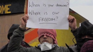 Inmigrantes en Calais se cosen la boca en protesta por su situación