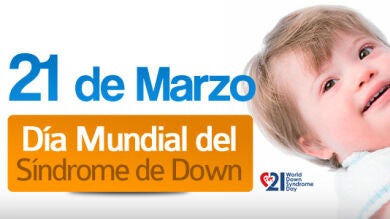 Mil personas con síndrome de Down participarán en un estudio pionero en el mundo para la detección precoz del Alzheimer