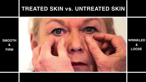 Frame 1.474591 de: Crean una piel artificial que elimina arrugas y protege del sol Frame 1.474591 de: Crean una piel artificial que elimina arrugas y protege del sol