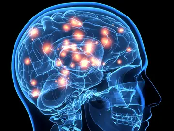 Cerebro Cerebro