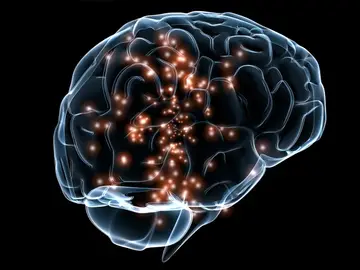 Recreación cerebro Recreación cerebro