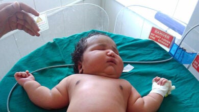 Nace en la India la niña más grande del mundo con casi 7 kilos, el peso que tiene una bebé de 6 meses