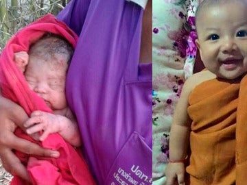 El antes y el después del bebé enterrado vivo en Tailandia