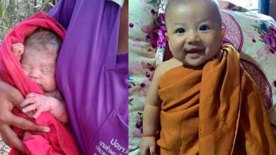 Así se ha recuperado un recién nacido que sobrevivó, milagrosamente, tras ser enterrado con 14 puñaladas en Tailandia