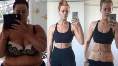 Una joven de 25 años fotografió cómo perdió 88 kilos en 20 meses durante el proceso
