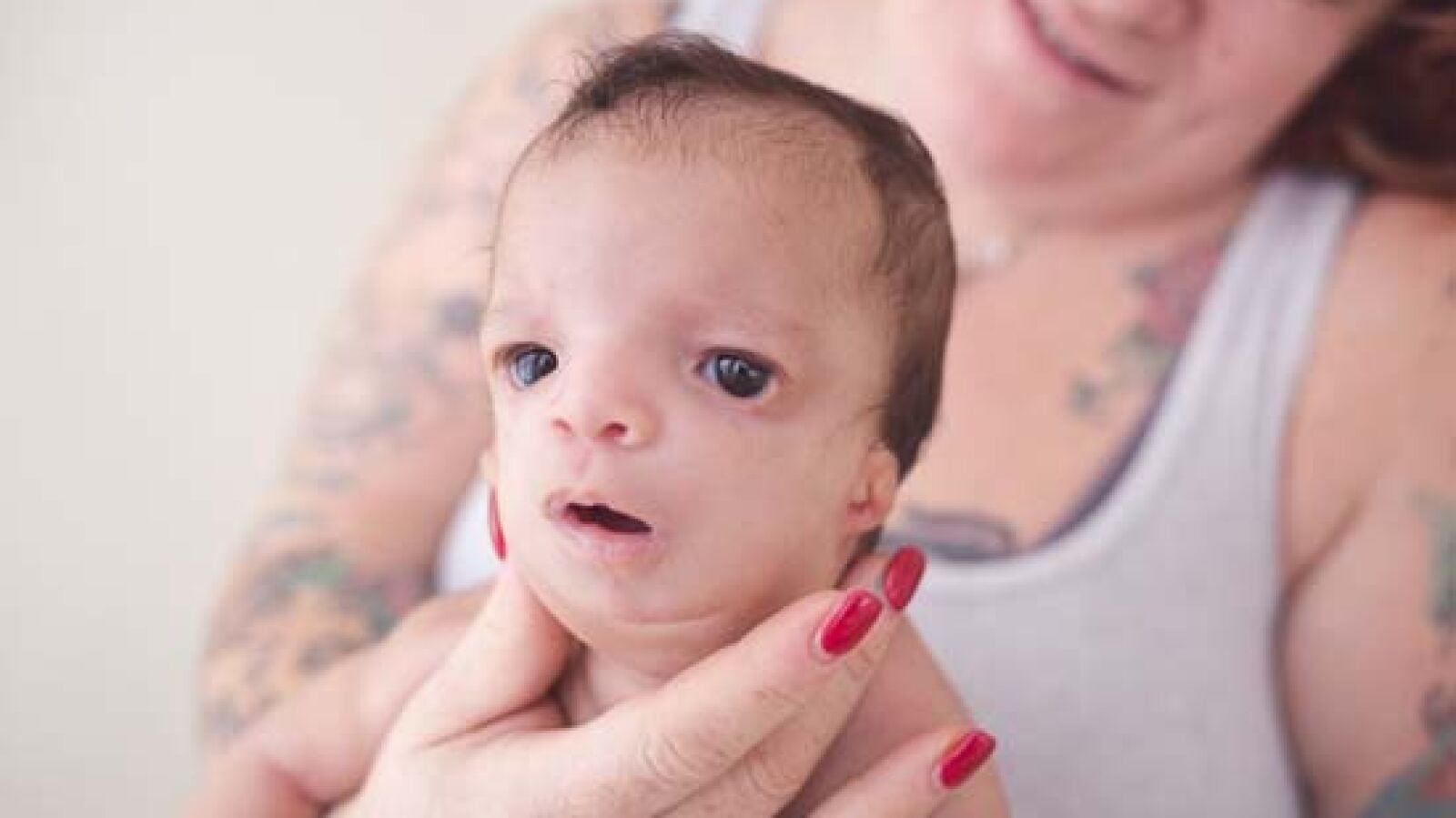 Unos padres adoptivos rechazan a su futuro bebé al ver que sufre malformaciones 