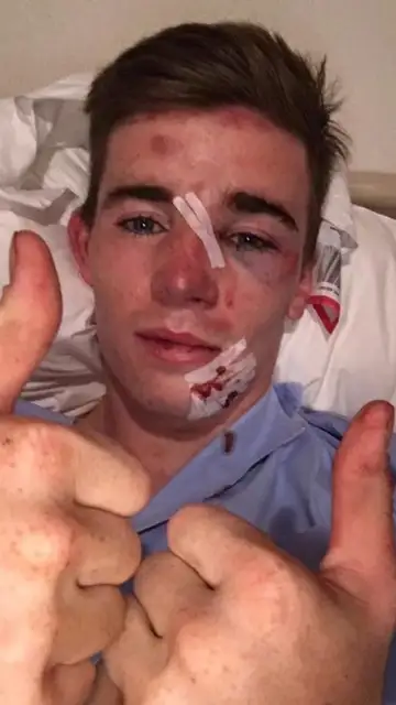 Joven atropellado por una ambulancia Joven atropellado por una ambulancia