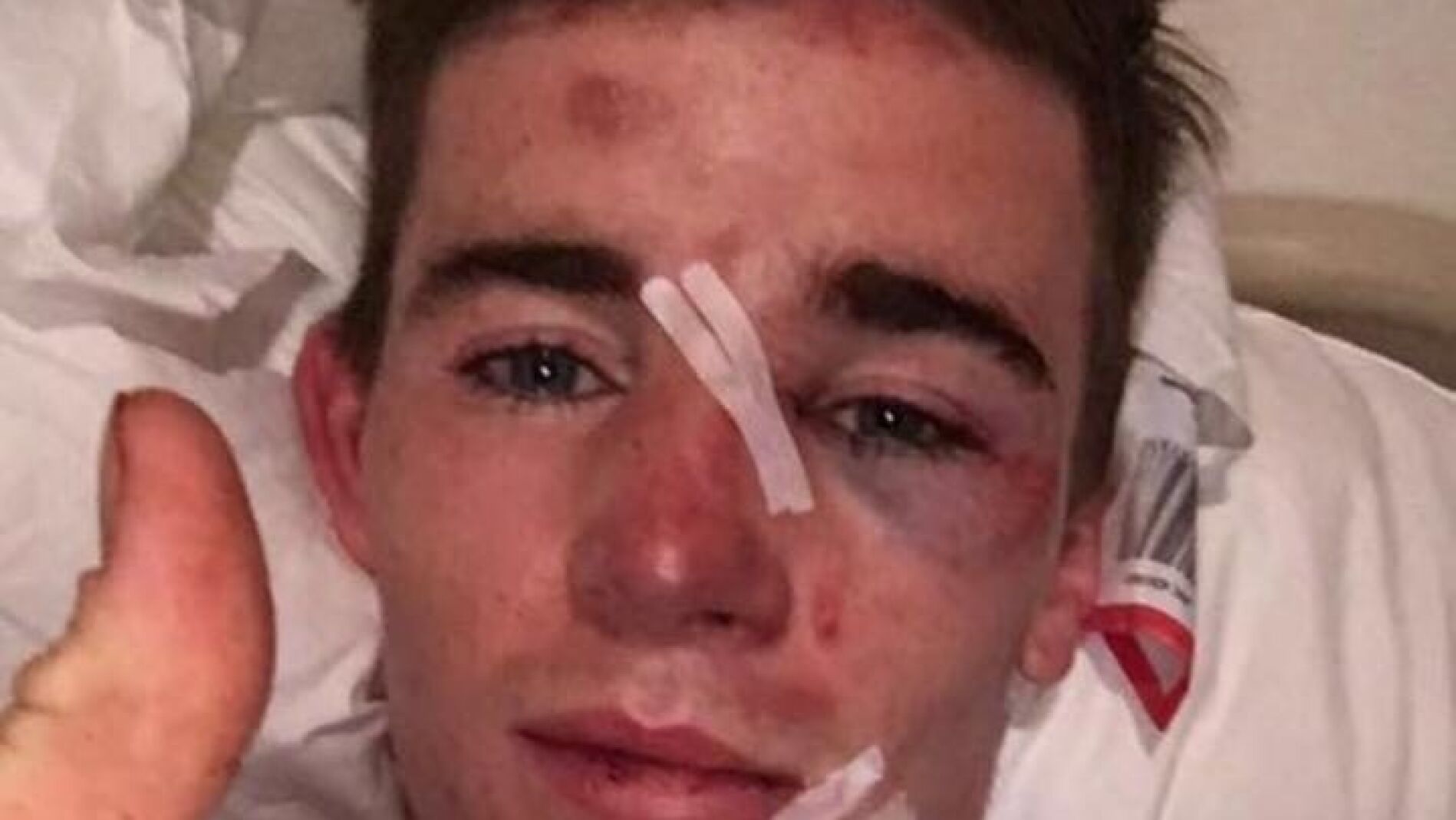 Joven atropellado por una ambulancia