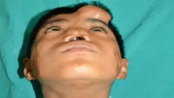 El niño con la nariz en la frente El niño con la nariz en la frente