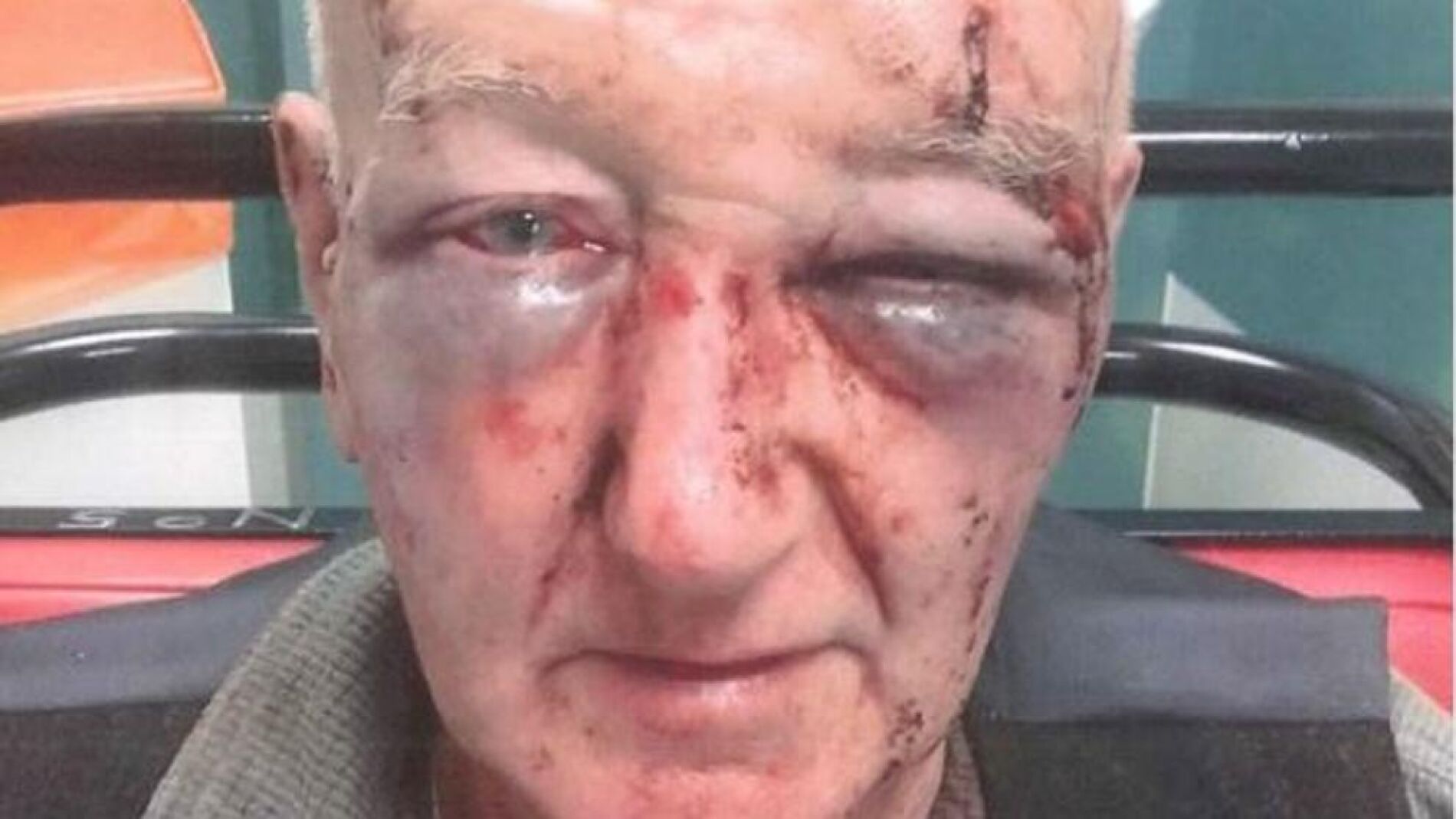 El hombre recibi&oacute; una brutal paliza tras increpar al joven.
