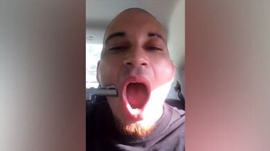 Un rapero se pega un tiro en la mejilla para incluir las imágenes en un vídeoclip
