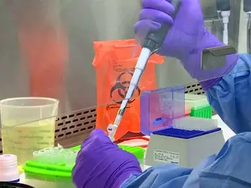 Vacuna virus Zika Vacuna virus Zika
