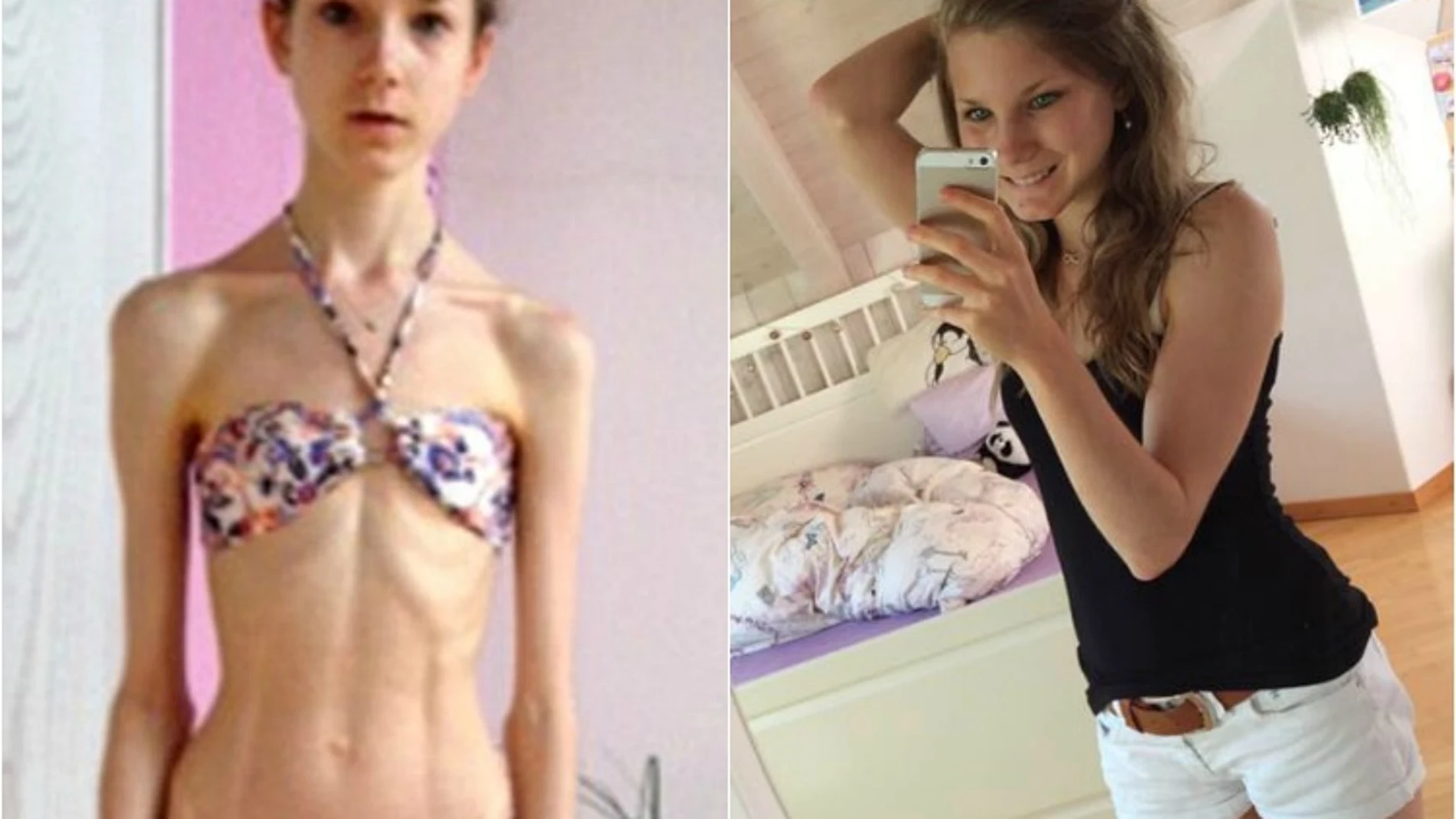 Chiara Schober, durante su enfermedad (i) y una vez superada (d) Chiara Schober, durante su enfermedad (i) y una vez superada (d)