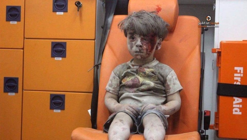 Un niño herido durante un bombardeo en Alepo